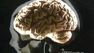 GLOC Gravity induced Loss Of Consciousness Part 1 of 2