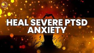 Heal Severe PTSD Anxiety IBS and Depression  Overcome Pain and Sleep Problems  Binaural Beats