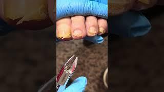 Satisfying pedicure video #pedicure #toenails