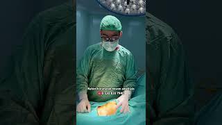 Rahim korunarak miyom ameliyatı uterine fibroid surgery ️+90 530 833 7940