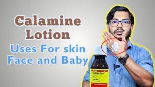 Calamine Lotion  ক্যালামাইন লোশন ব্যবহারের নিয়ম