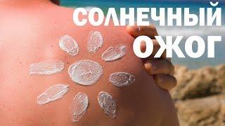 Что делать при солнечном ожоге. Сгорел на солнце? Аюрведа Здесь