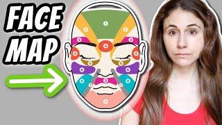 What can FACE MAPPING YOUR ACNE tell you?  Dr Dray