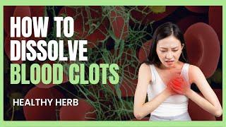 7 Natural Remedies to dissolve BLOOD CLOTS & Boost Vascular Health