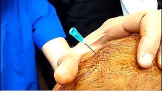 Epidural anesthesia in cattle calf