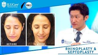 Rhinoplasty vs Septoplasty Better Breathing and Reshaping the Nose - Fox 2