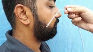 NASOGASTRIC INTUBATION -RYLES TUBE FEEDING TUBE INSERTION