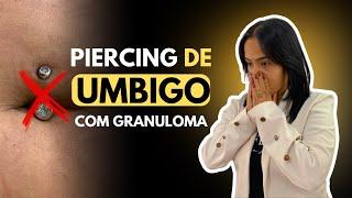 Piercing de Umbigo com Granuloma