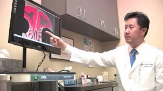 Sinus Headache & Facial Pressure with Head & Neck Surgeon Dr. CT Nguyen