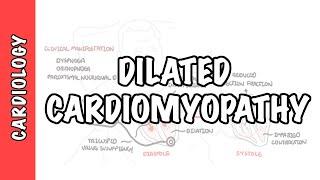 Dilated Cardiomyopathy - causes symptoms pathophysiology and treatment