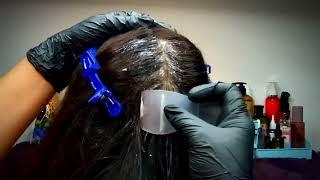 ASMR Scalp Check Dandruff Flakes With Coconut Treatment  No Talking