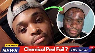 Chemical Peel Fail? TikToker Neyo White chemical peel gone wrong @ Diamond Facez Skincare Bar ?