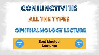 ConjunctivitisPink Eye in the eye lecture - Symptoms Treatment Types