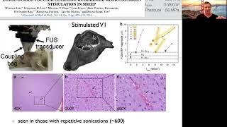 Ultrasound neuromodulation safety and FDA guidelines