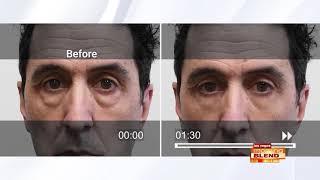 Get Rid Of Under Eye Bags In Minutes