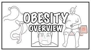 Approach to OBESITY and Weight gain - causes risk factors BMI complications and treatment