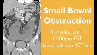 Facebook Live Small Bowel Obstruction SBO