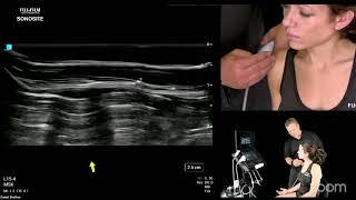 Diagnostic Shoulder Ultrasound Part 1 - Anterior Shoulder