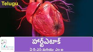 Heart Attack ACS & MI  Telugu