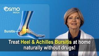 Achilles Bursitis  Retrocalcaneal bursitis Heel bursitis treatment