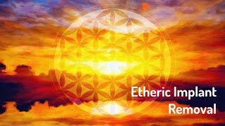 Etheric Implant Removal ReikiEnergy HealingFrequency Healing Music