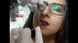 Kızılay Dudak Piercing  Delimi  D&S TATTOO