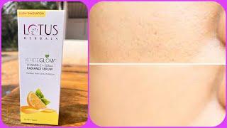 Lotus whiteglow vitamin c gold radiance serum review  लगाने से पहले इस video को जुरूर देखिये