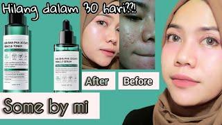 REVIEW JUJUR PEMAKAIAN SOME BY MI AHA BHA PHA 30 DAYS MIRACLE TONER & MIRACLE SERUM SECARA RUTIN