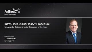 IntraOsseous BioPlasty® Procedure for Juvenile Osteochondritis Dissecans of the Knee