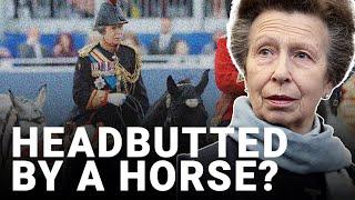 Princess Anne’s mysterious head injury ‘consistent with being struck by horse’s head or legs’