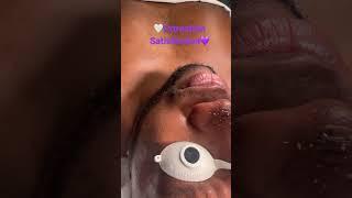 Male facial. #extraction #oilyskin #esthetician #viral