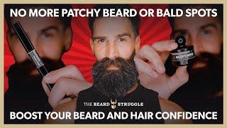 Thin Balding Hair - Patchy Beard - Bald Spots  Quick & Easy Fix  Baldrs Arrow from TBS