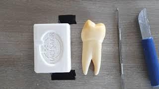 Sabundan üst çene 1.küçük azı diş yapımıKRON BÖLÜMÜMaxillary first premolar in soap