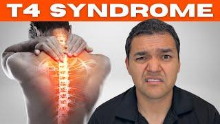 Upper Back Pain From T4 Syndrome Everything You Need To Know