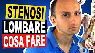 Stenosi Lombare le Cause e la Fisioterapia