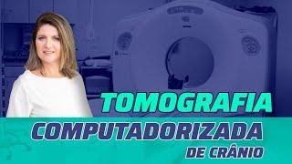 TOMOGRAFIA COMPUTADORIZADA DE CRÂNIO PASSO A PASSO