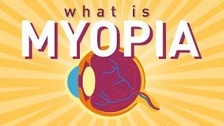 What is Myopia Short sightedness?