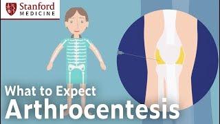 Arthrocentesis – What to Expect