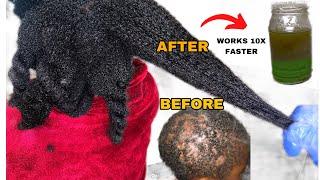 HAIR TONICIF CLOVES DIDNT WORK FOR U USE THIS HAIR GROWTH TONIC FOR OVERNIGHT GROWTHMay 27 2024