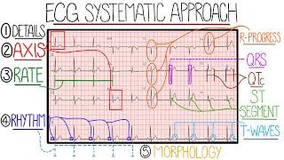 ECG Interpretation Made Easy Learn How to Interpret an ECG in 13 Minutes