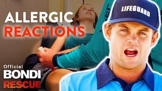 INTENSE Allergic Reactions That Challenge Lifeguards