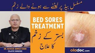 Bed Sores Prevention - Bistar Ke Zakham Ka Ilaj - Bed Sores Ka Ilaj - How To Treat Pressure Ulcers