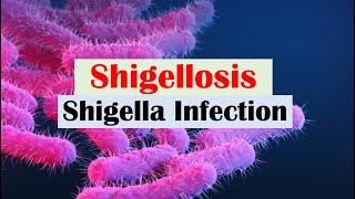 Shigellosis Shigella “A Cause of Bloody Diarrhea” Pathophysiology Symptoms Diagnosis Treatment