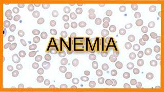 Anemia Types Findings Lab Values