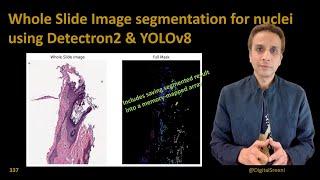 337 - Whole Slide Image segmentation for nuclei​ using Detectron2 and YOLOv8