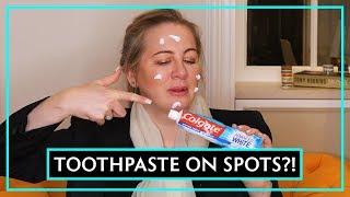 Dr Debunks Does Toothpaste Get Rid Of Spots?