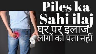 Piles treatment at home in Hindi  Bavasir ka ilaj