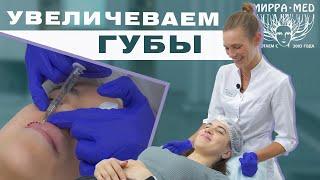 Увеличение губ  КОНТУРНАЯ ПЛАСТИКА ГУБ  Juvederm 1 mg