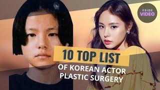 10 Top List Of Korean Actor PLASTIC SURGERY