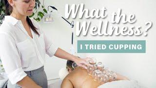 Cupping Therapy Treatment   What the Wellness  Well+Good